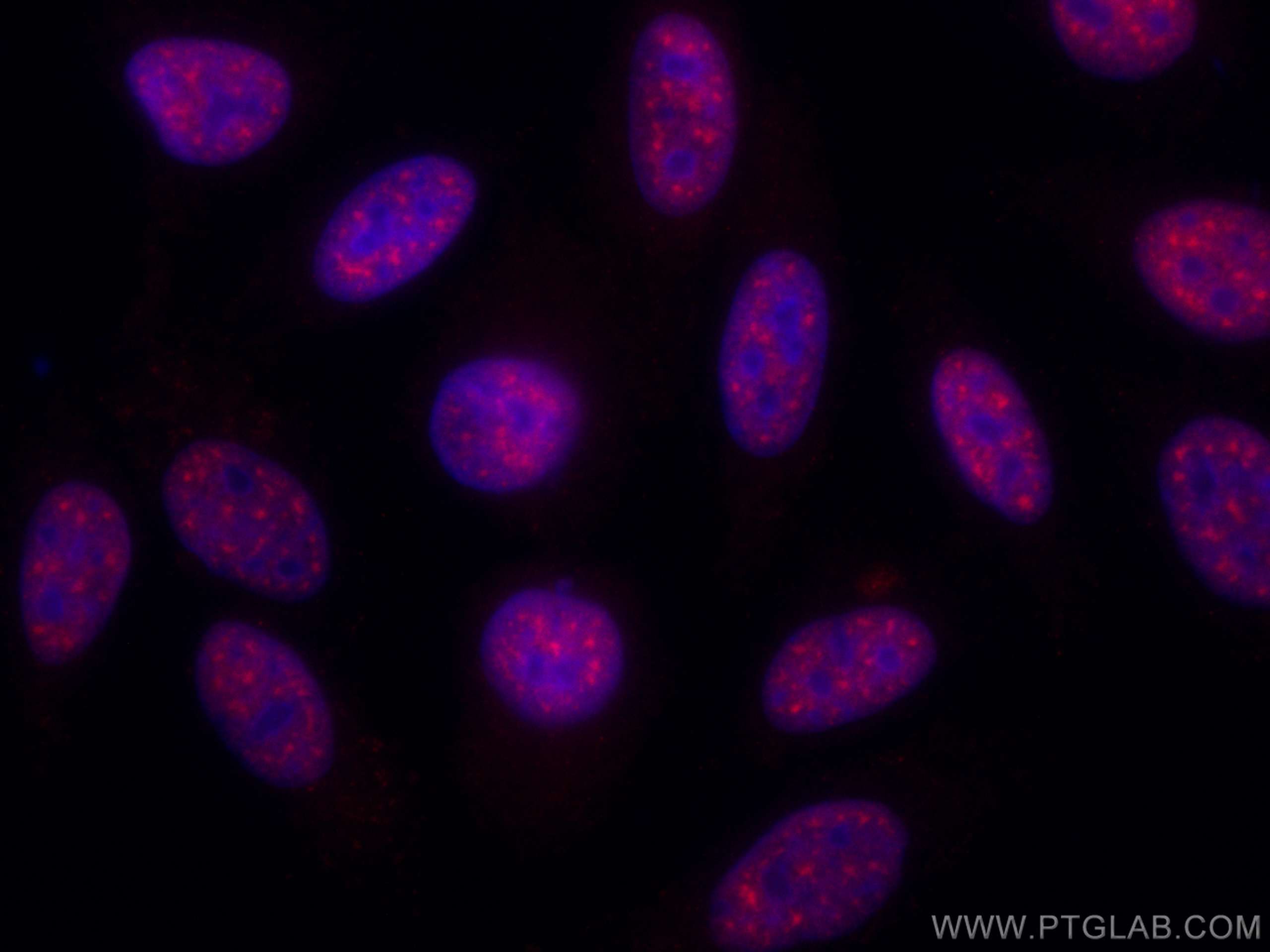 IF Staining of HepG2 using CL594-67469