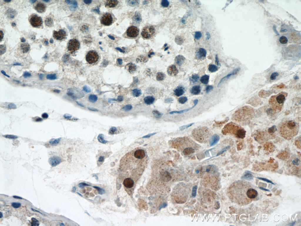 IHC staining of human testis using 15614-1-AP