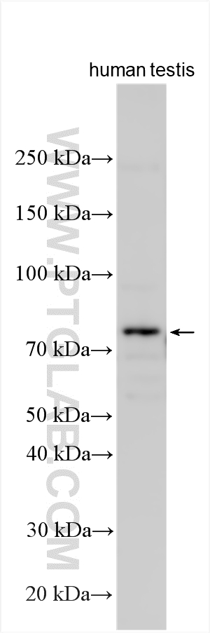 WB analysis using 15614-1-AP