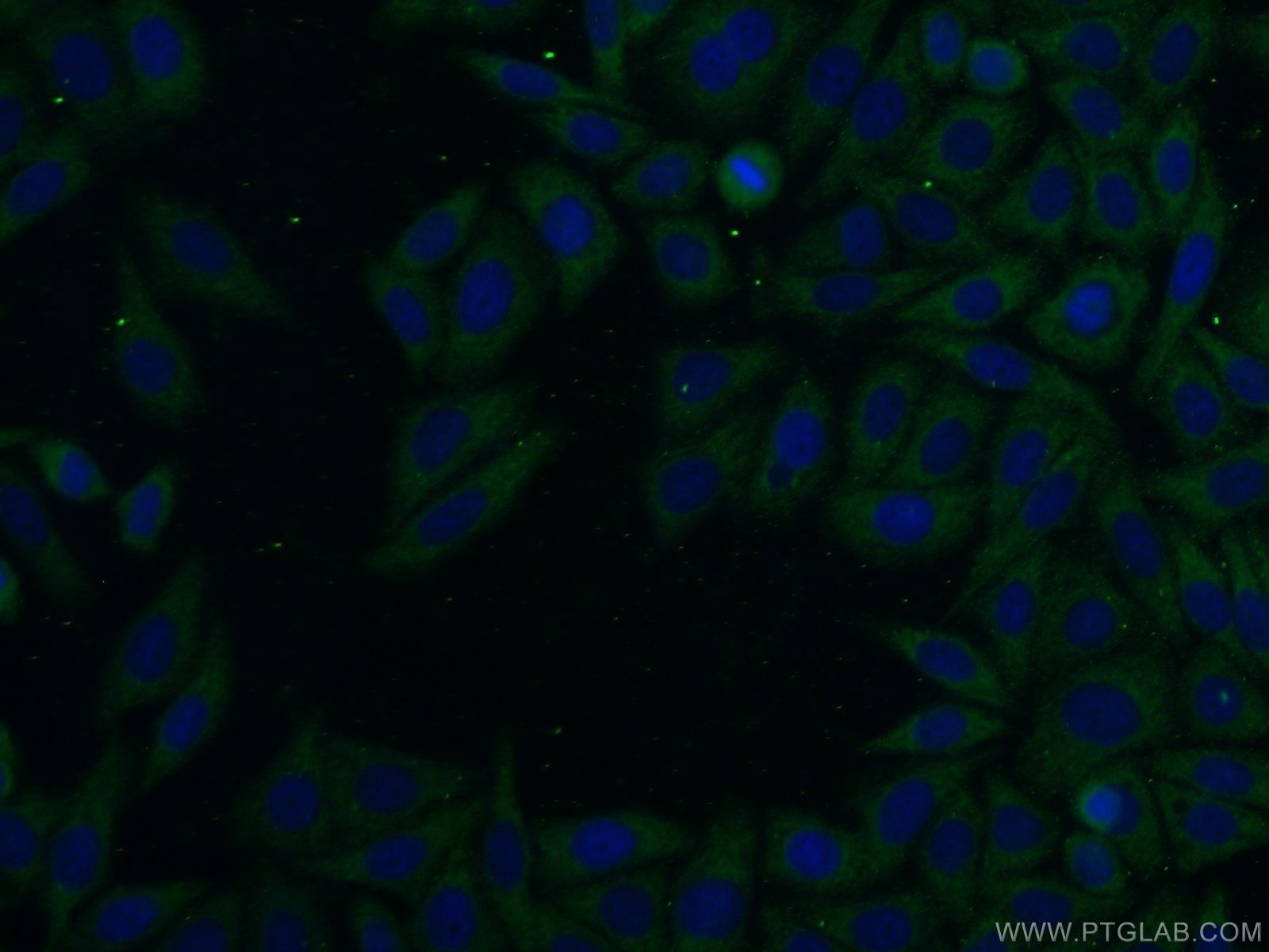 IF Staining of HepG2 using 13550-1-AP