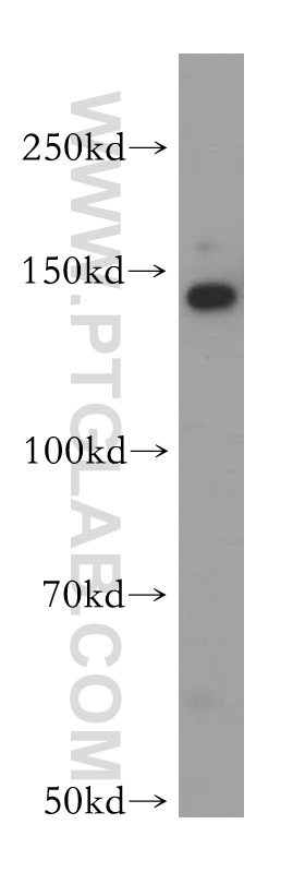 WB analysis of A549 using 13550-1-AP