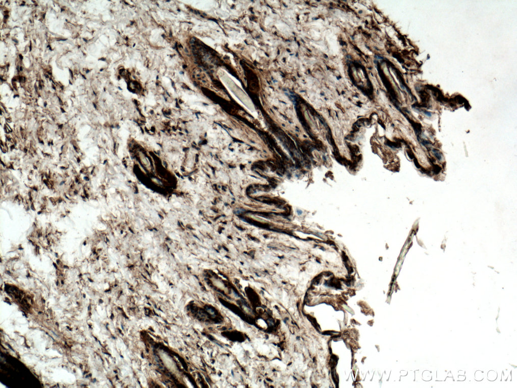IHC staining of mouse skin using 10622-1-AP