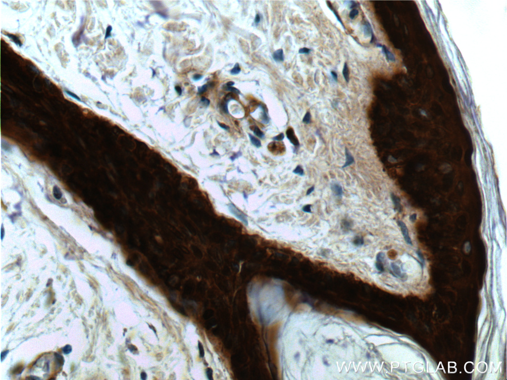 IHC staining of human skin using 66251-1-Ig (same clone as 66251-1-PBS)