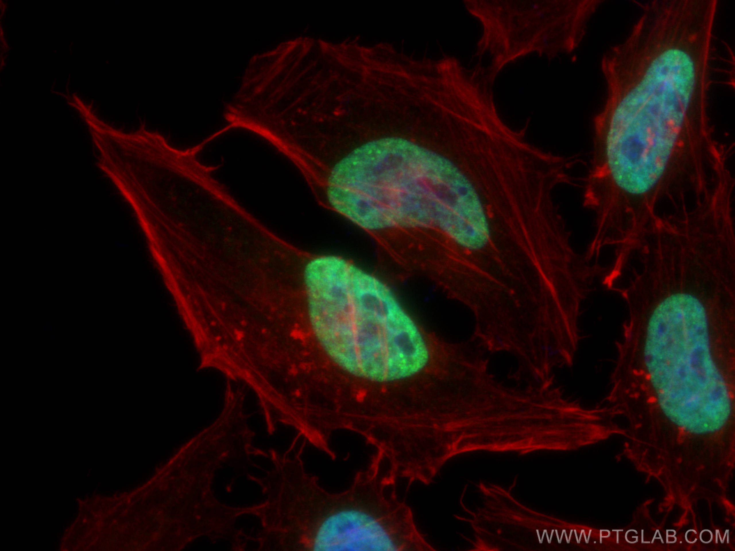 IF Staining of HeLa using 15585-1-AP
