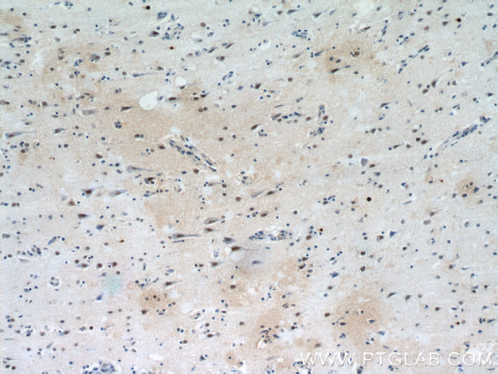 IHC staining of human brain using 15585-1-AP