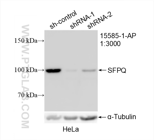 WB analysis of HeLa using 15585-1-AP