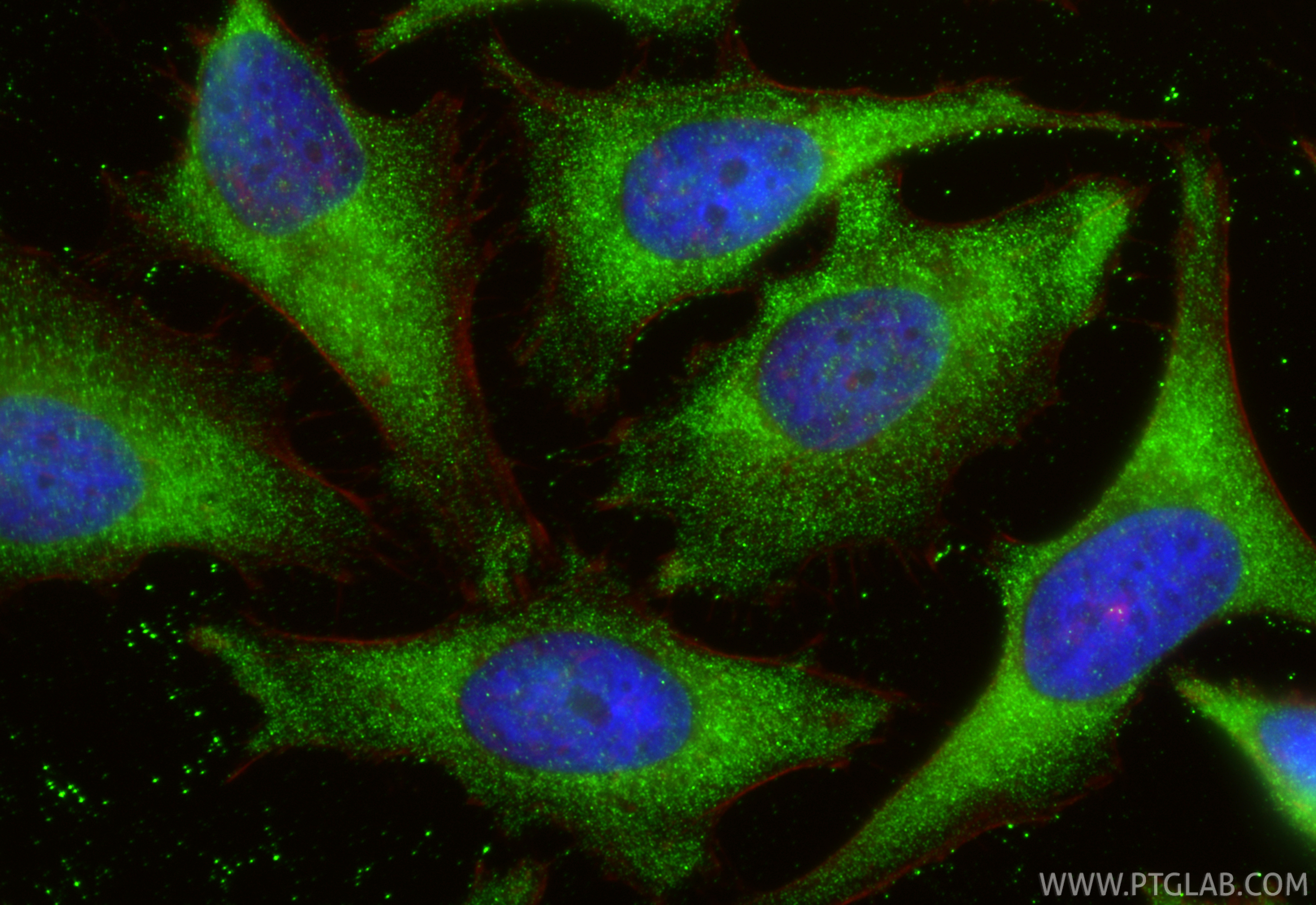 IF Staining of HeLa using 26460-1-AP