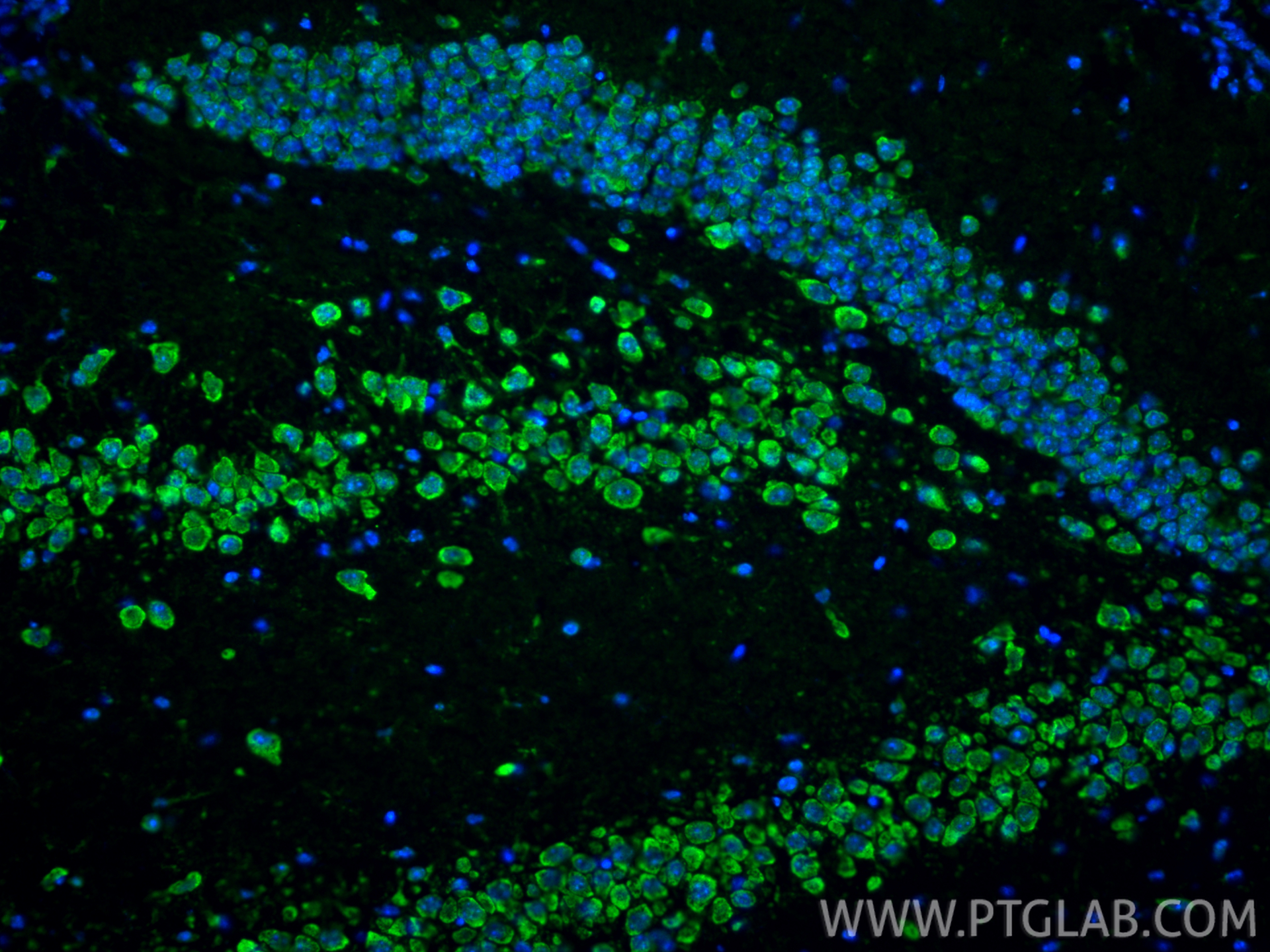 Immunofluorescent analysis of (4% PFA) fixed frozen OCT-embedded mouse brain tissue using SFRP1 antibody (26460-1-AP) at dilution of 1:400 and CoraLite®488-Conjugated Goat Anti-Rabbit IgG(H+L) (<a class='green' href='/productredirect?CatalogNo=SA00013-2' target='_blank'>SA00013-2</a>). IF Staining of mouse brain using 26460-1-AP