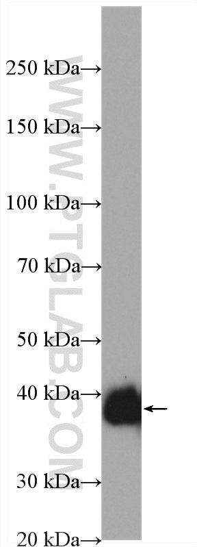 WB analysis of human testis using 28271-1-AP