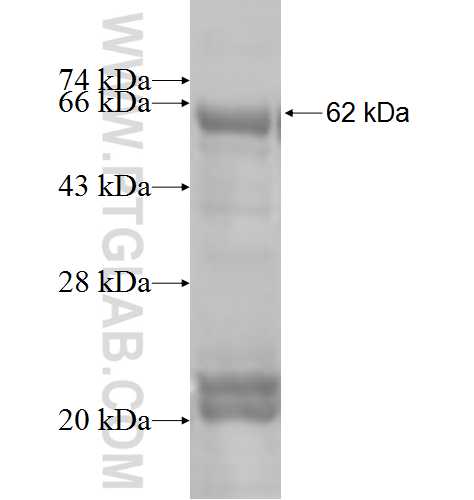 SFRP1 fusion protein Ag4763 SDS-PAGE SFRP1 fusion protein Ag4763 SDS-PAGE