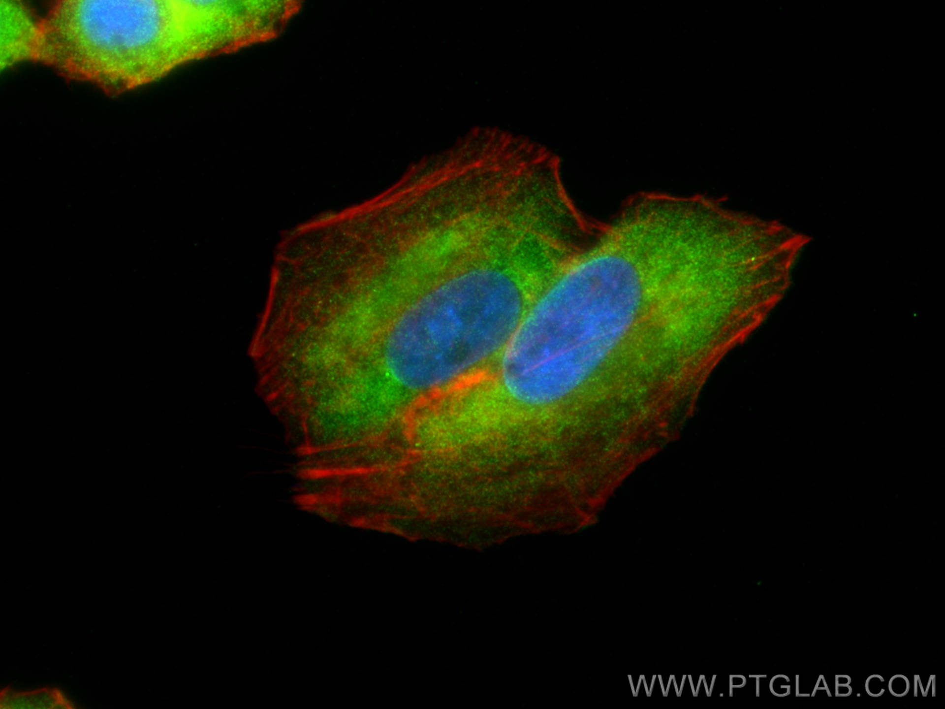 IF Staining of A549 using 12189-1-AP