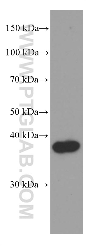 WB analysis of rat brain using 66328-1-Ig