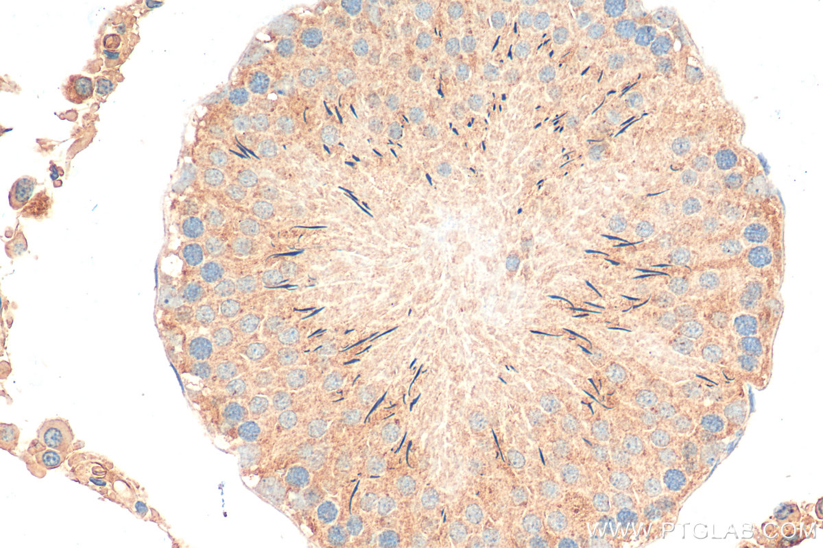IHC staining of rat testis using 15328-1-AP (same clone as 15328-1-PBS)
