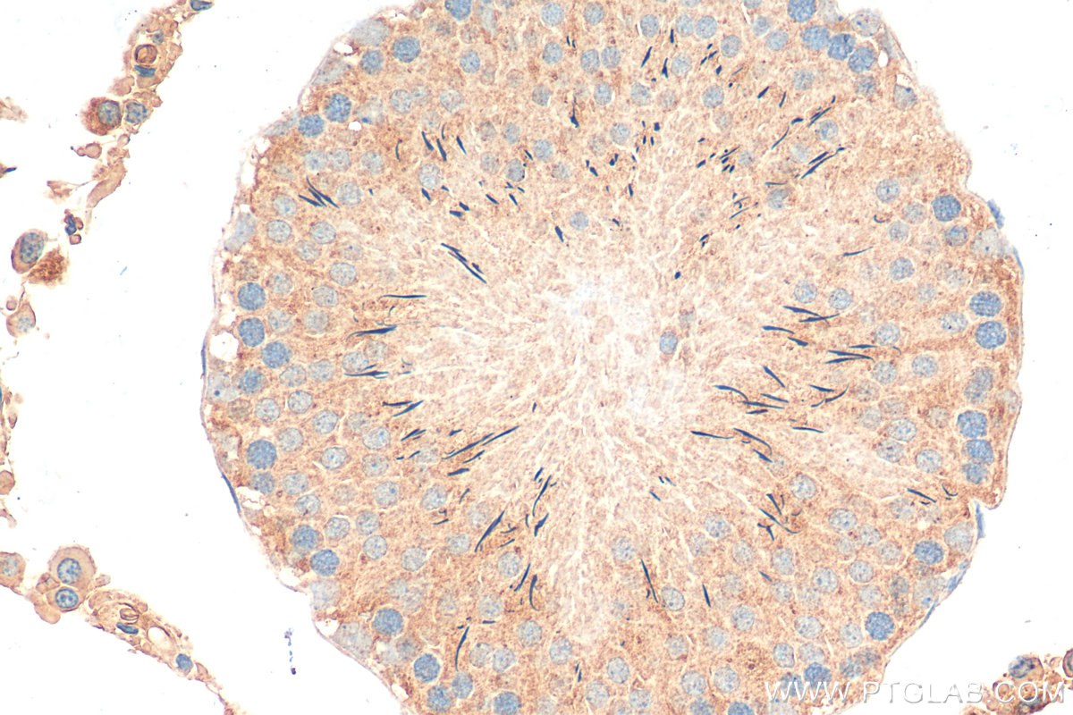 IHC staining of rat testis using 15328-1-AP