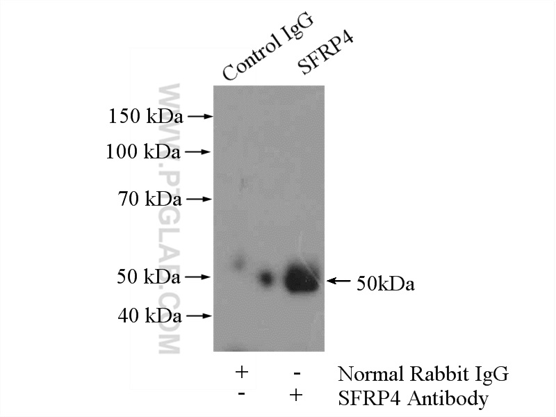 IP experiment of HeLa using 15328-1-AP (same clone as 15328-1-PBS)