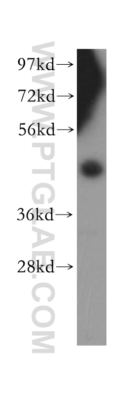WB analysis of HEK-293 using 15328-1-AP (same clone as 15328-1-PBS)