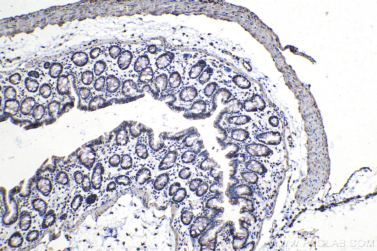 IHC staining of rat colon using 26751-1-AP