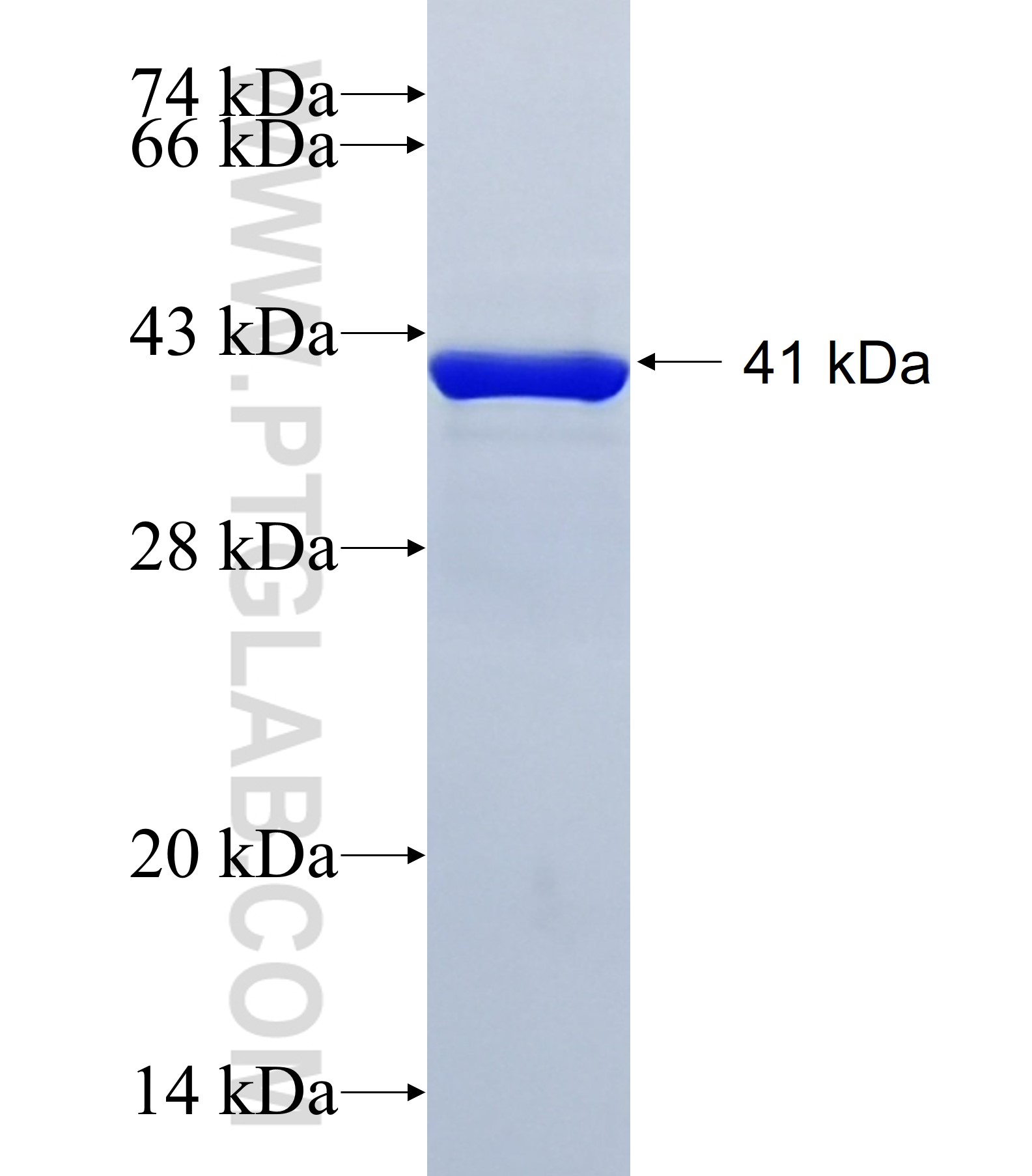 SFRS12 fusion protein Ag41742 SDS-PAGE SFRS12 fusion protein Ag41742 SDS-PAGE