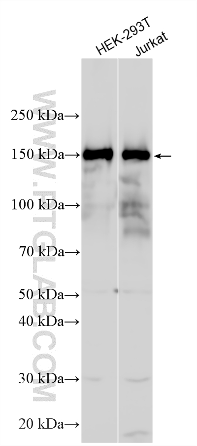 WB analysis using 33589-1-AP