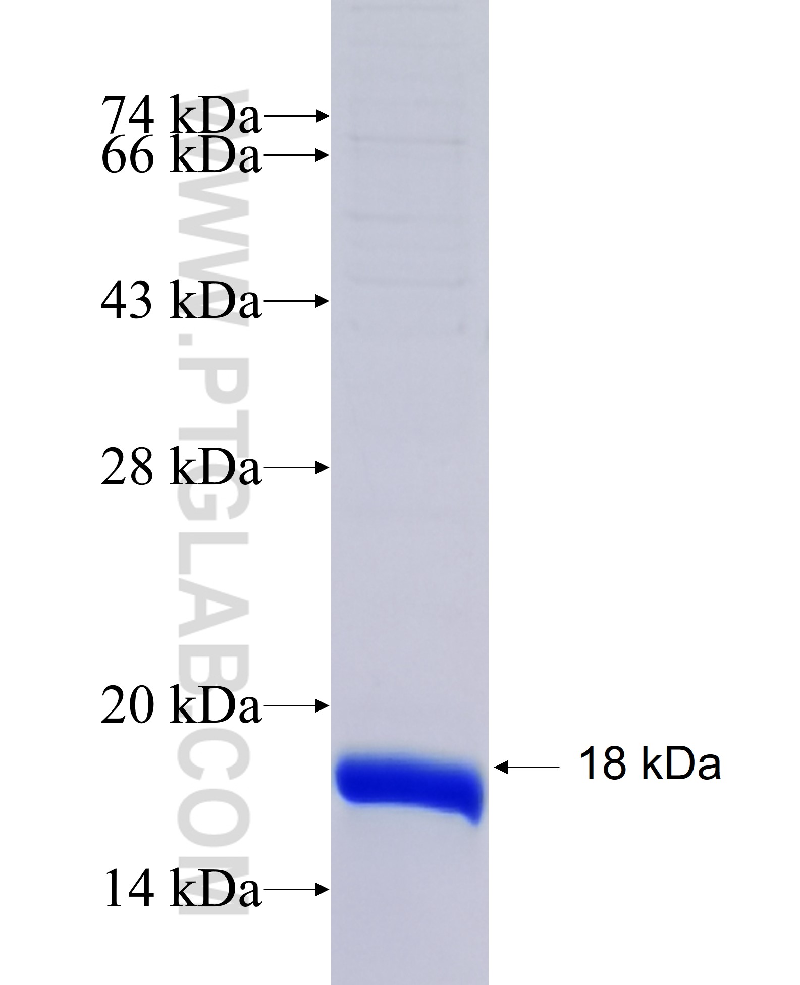 SFRS2 fusion protein Ag17177 SDS-PAGE