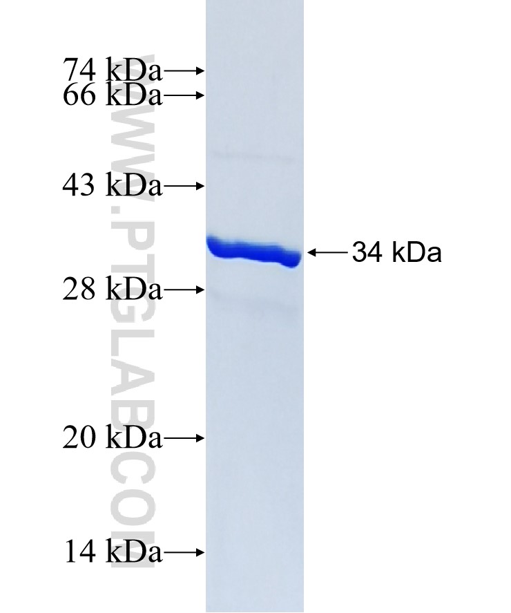 SFRS2B fusion protein Ag38530 SDS-PAGE SFRS2B fusion protein Ag38530 SDS-PAGE