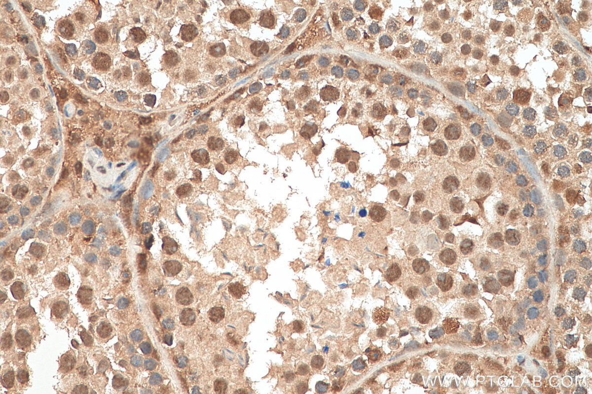 IHC staining of mouse testis using 10916-1-AP