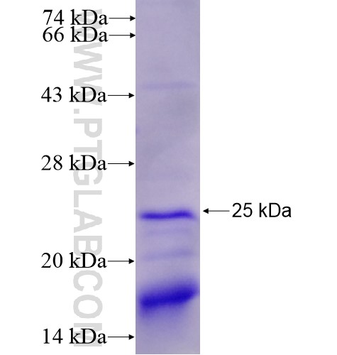 SRp20 fusion protein Ag13184 SDS-PAGE SRp20 fusion protein Ag13184 SDS-PAGE