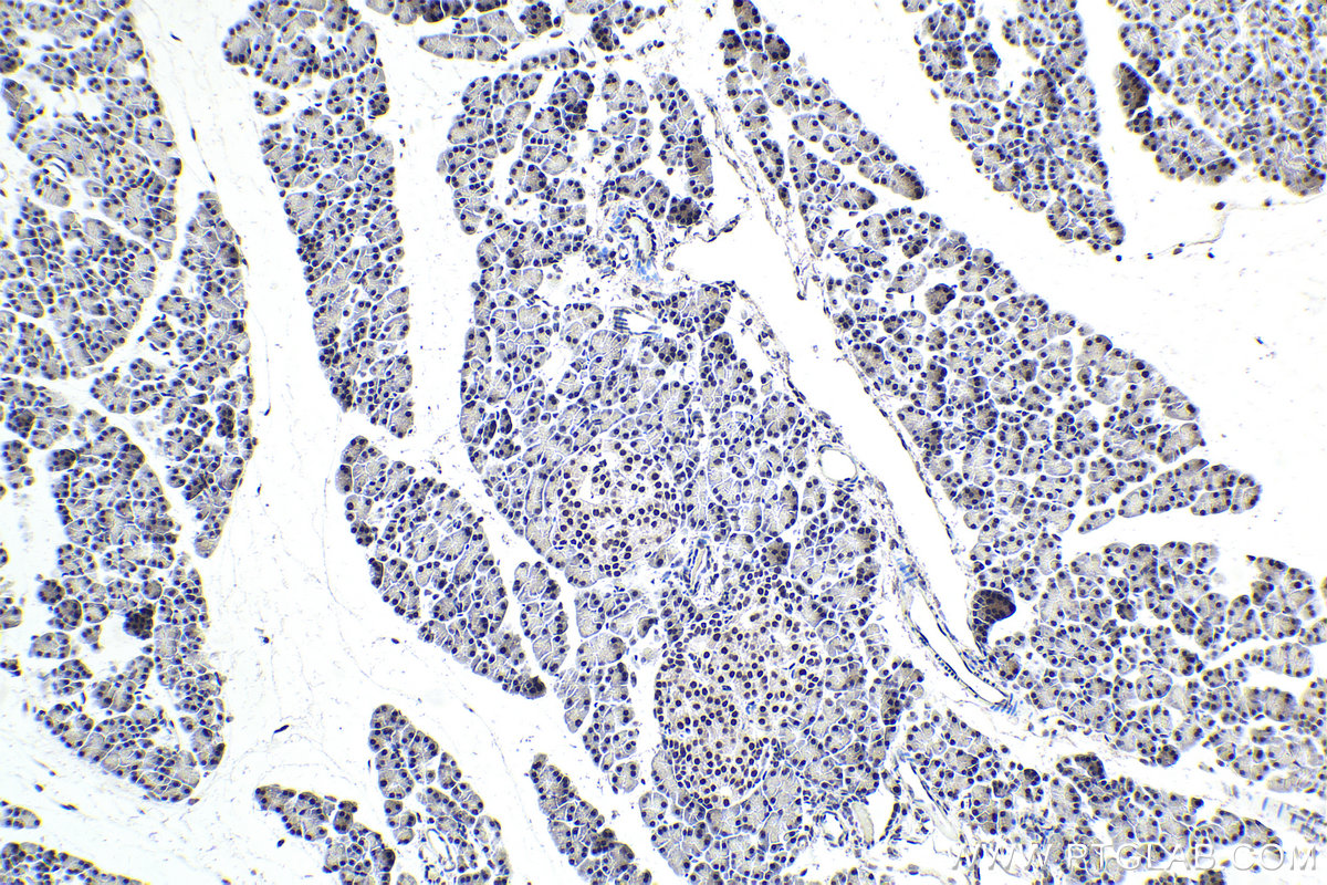 IHC staining of rat pancreas using 16237-1-AP