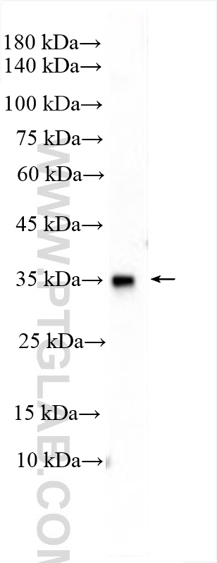 WB analysis of mouse testis using 11044-1-AP