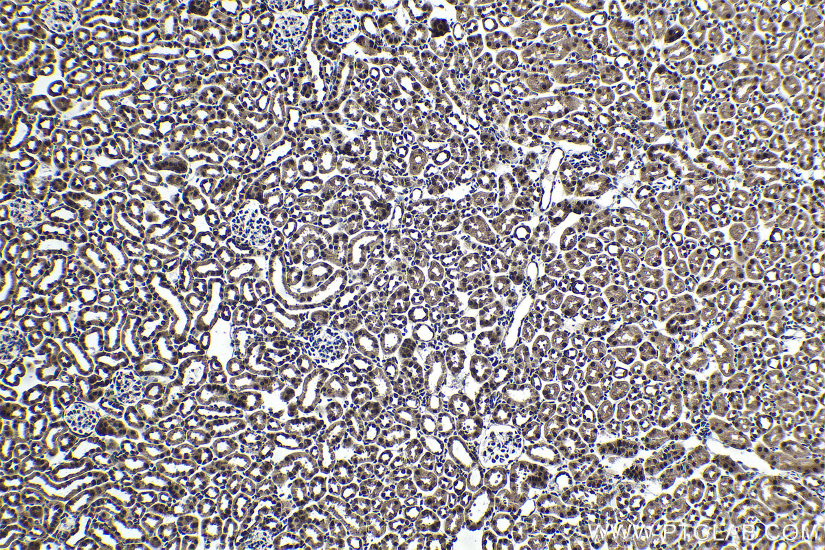 IHC staining of mouse kidney using 17926-1-AP