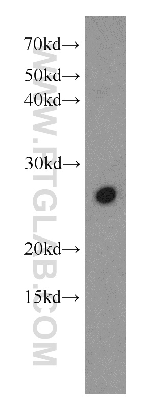 WB analysis of HEK-293 using 17926-1-AP