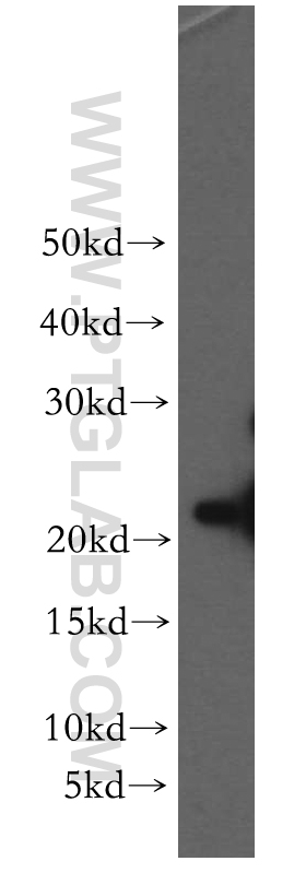 WB analysis of HeLa using 19758-1-AP