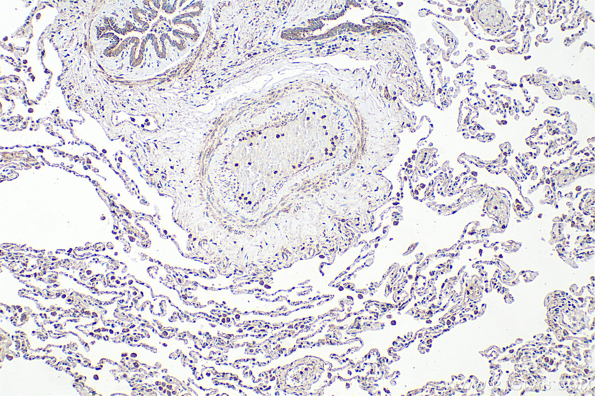 IHC staining of human lung using 21145-1-AP (same clone as 21145-1-PBS)