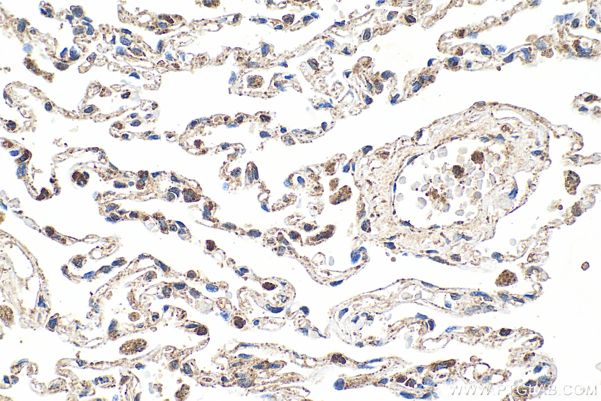 IHC staining of human lung using 21145-1-AP (same clone as 21145-1-PBS)