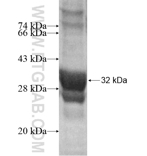 SFTA2 fusion protein Ag15656 SDS-PAGE SFTA2 fusion protein Ag15656 SDS-PAGE