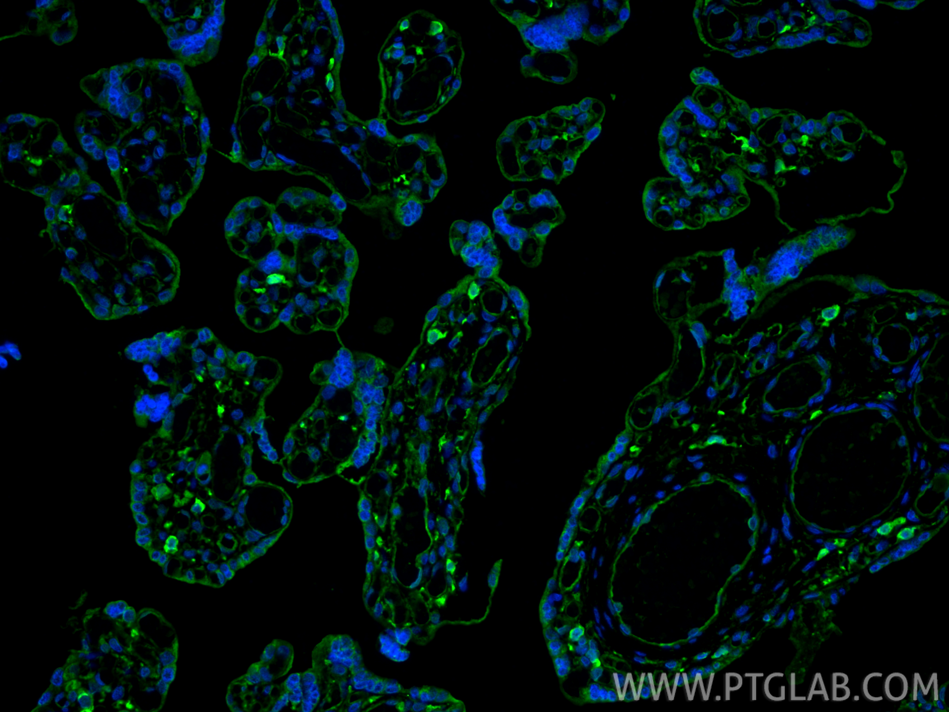 IF Staining of human placenta using 11850-1-AP