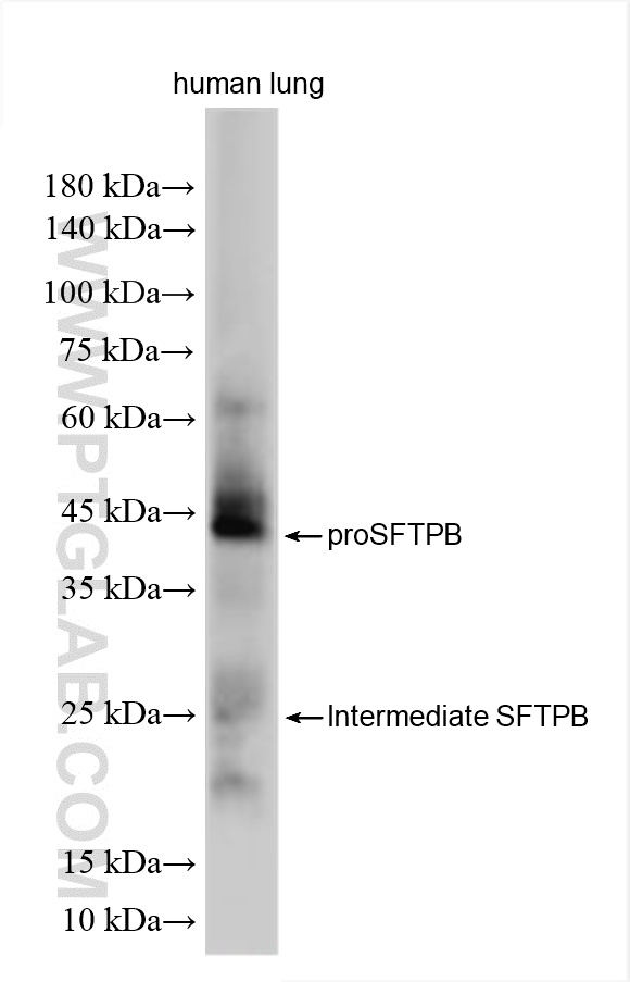 WB analysis using 13664-1-AP