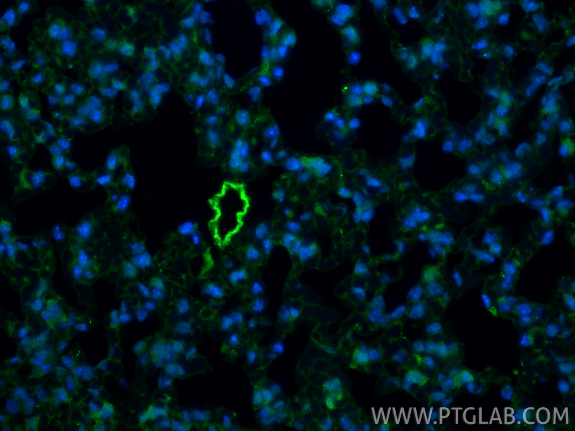 IF Staining of mouse lung using 11839-1-AP