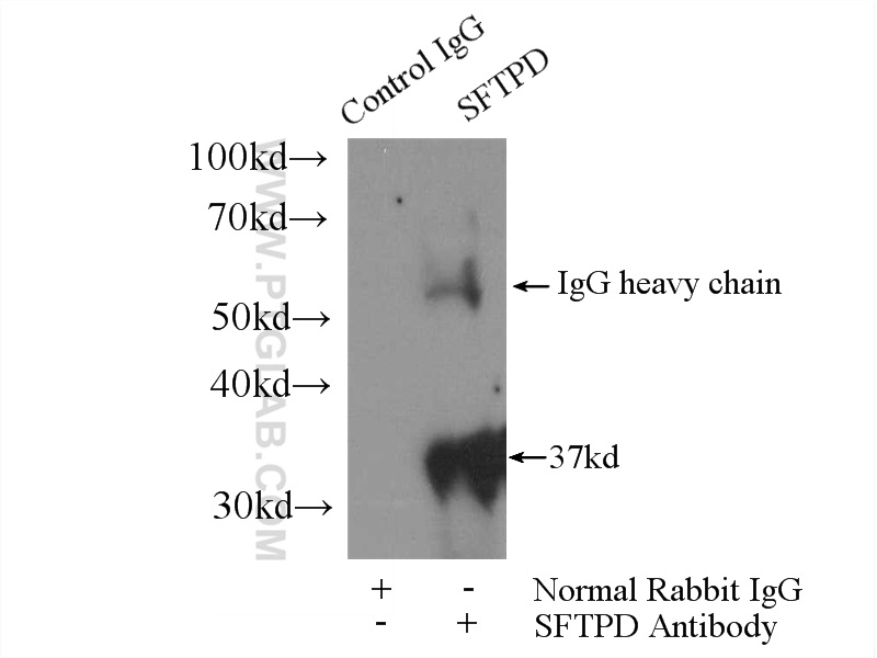 IP experiment of mouse lung using 11839-1-AP