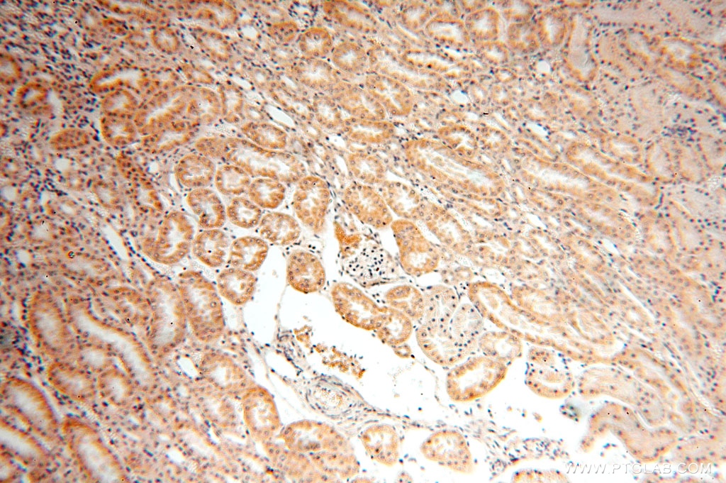 IHC staining of human kidney using 15985-1-AP