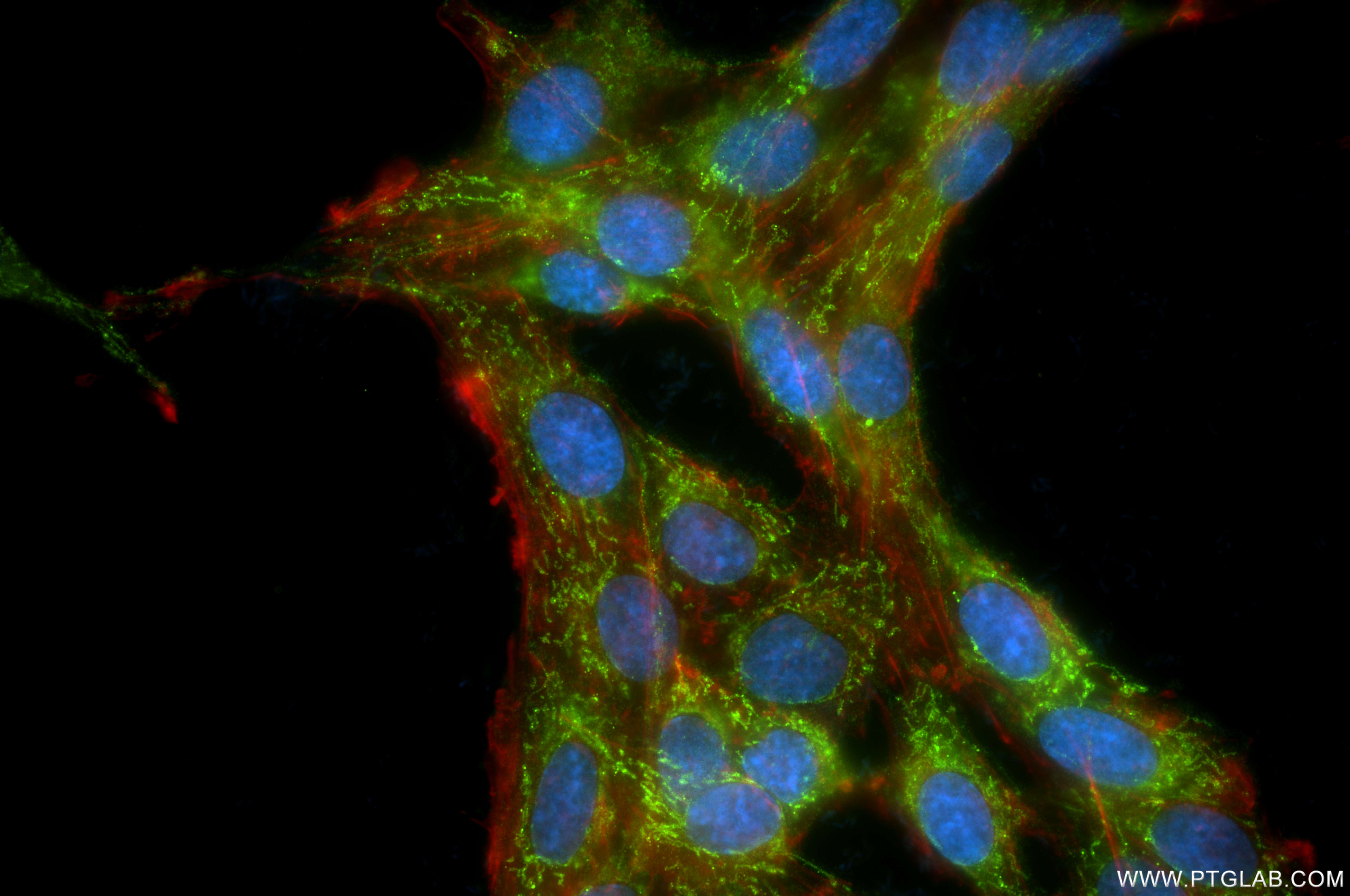 IF Staining of C6 using 85978-1-RR