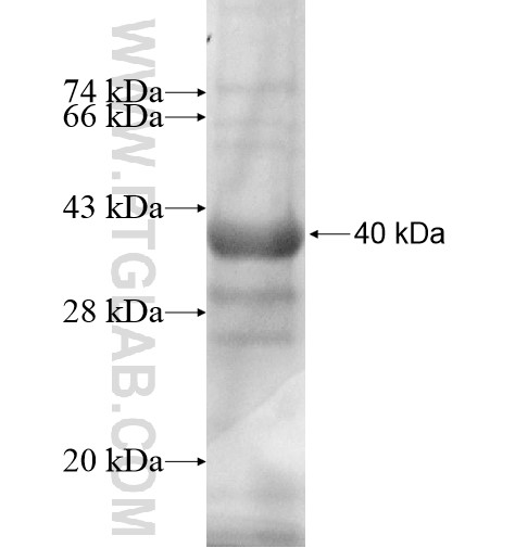 SFXN4 fusion protein Ag11864 SDS-PAGE SFXN4 fusion protein Ag11864 SDS-PAGE