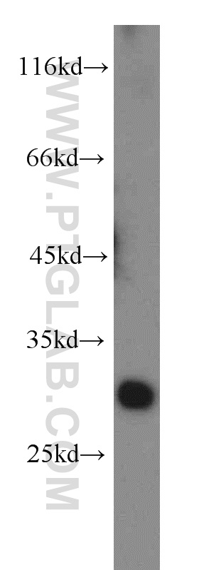 WB analysis of human skeletal muscle using 13222-1-AP