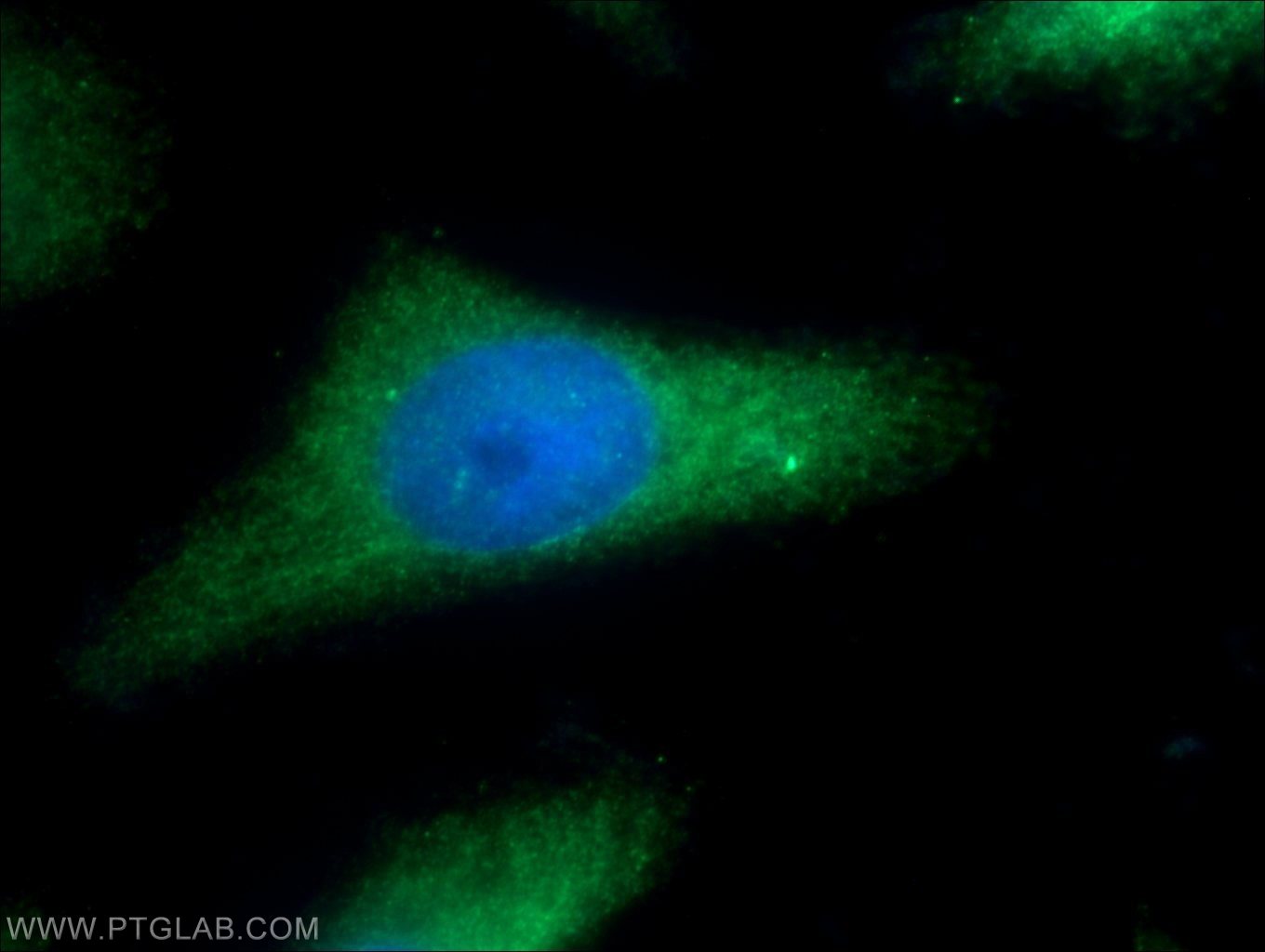 IF Staining of HeLa using 12407-1-AP