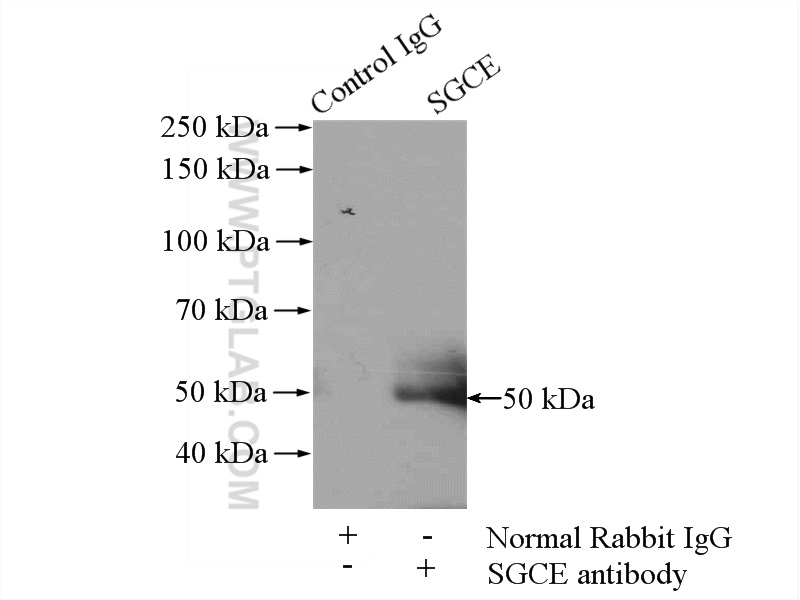 IP experiment of mouse heart using 12407-1-AP