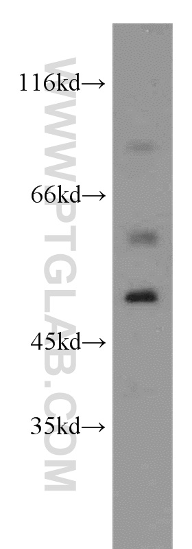 WB analysis of mouse brain using 12407-1-AP