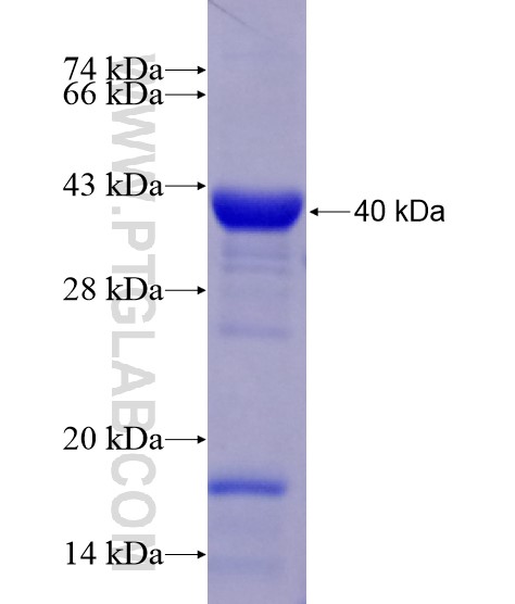SGCE fusion protein Ag28611 SDS-PAGE SGCE fusion protein Ag28611 SDS-PAGE