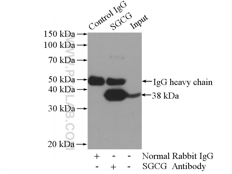 IP experiment of mouse heart using 18102-1-AP