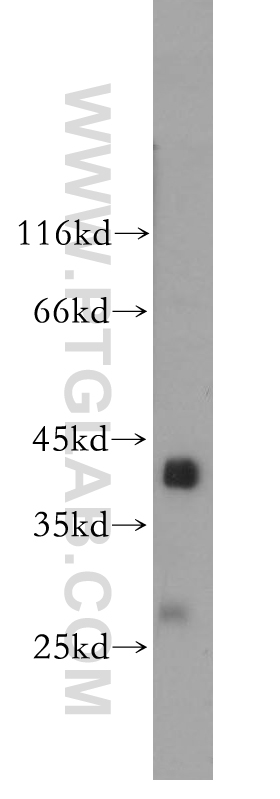 WB analysis of human skeletal muscle using 18102-1-AP