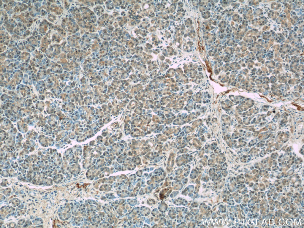 IHC staining of human pancreas using 23394-1-AP